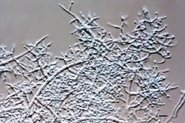 Trichoderma là gì?