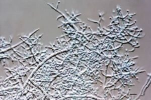 Nấm Trichoderma dưới kính hiển vi