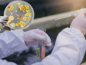 Điều kiện thích nghi của các men vi sinh