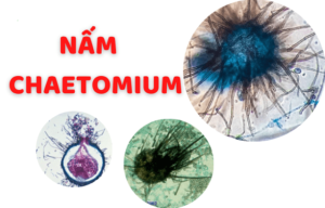 Nấm đối kháng Chaetomium rất có lợi cho cây trồng