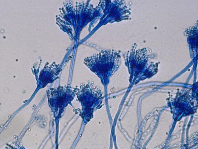 Aspergillus Oryzae là một loại nấm sợi, có màu sắc từ vàng đến nâu Aspergillus Oryzae là một loại nấm sợi, có màu sắc từ vàng đến nâu
